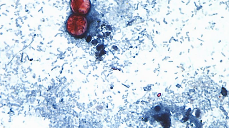 Cyclospora: mueren dos personas a causa del brote de diarrea explosiva en EU