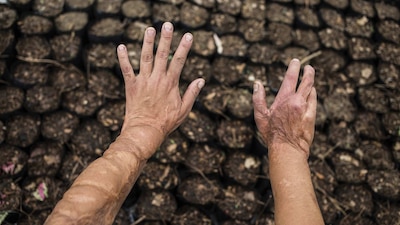 El odio deja marcas emocionales y físicas