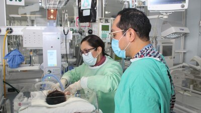 El tumor era más grande que la cabeza de la bebé y ponía en riesgo su vida.