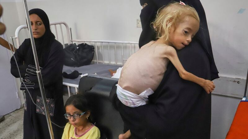 México respalda a la ONU por crisis de hambruna en Gaza, pero evita señalar a Israel