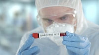 ¿Norovirus o hantavirus? Detienen nuevo buque, en Francia, tras brote de gastroenteritis y 1 muerto