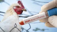 Reportan la primera muerte de una persona por gripe aviar en Estados Unidos