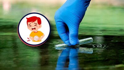 Es importante hervir el agua que consumimos