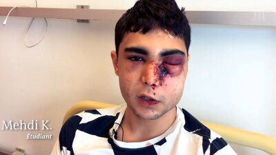 Este joven de 21 años fue golpeado por los policías durante una protesta