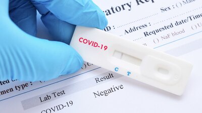 Si eres empleado de gobierno y ya te vacunaste, no es necesario mostrar una prueba