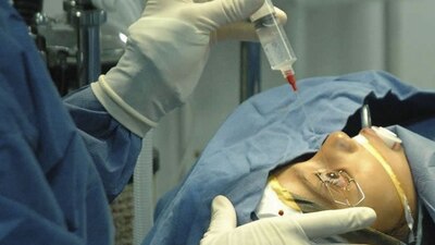 Un estudio de la Revista Británica de Oftalmología comparó las córneas de pacientes con y sin COVID