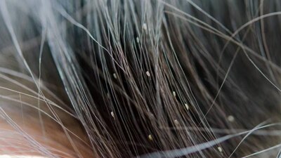 Son del tamaño de una semilla de ajonjolí, tienen seis patas y su color es entre grisáceo y blanco