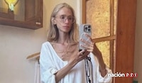Muere influencer de 27 años, tras seguir estricta dieta a base de frutas