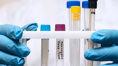 Las autoridades informaron que el caso se reportó durante la semana en NY