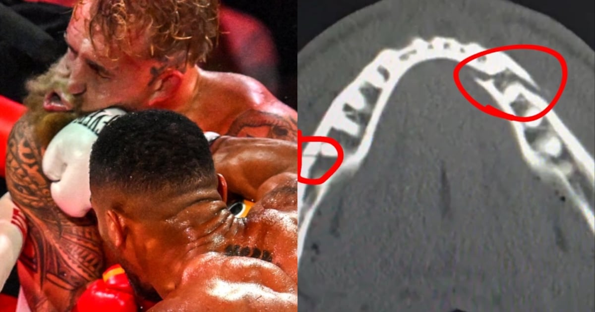 VIDEO: El poderoso golpe con el que el youtuber Jake Paul terminó con ...