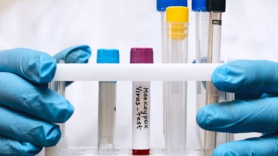 El director de la OMS, dijo que habrá una reunión para hablar sobre el tema el 18 de julio