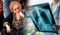 ¿Qué es un colapso de pulmón, problema de salud que tiene Silvia Pinal?