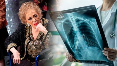 La actriz sigue hospitalizada, pese a que ingresó por una infección urinaria, se complicó