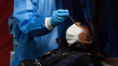 Entre los primeros síntomas de la variante ómicron están el dolor de garganta, tos y ronquera.