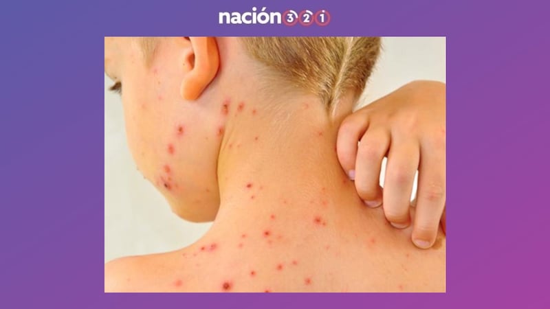 Sarampión en Durango: muere niño jornalero de ocho años