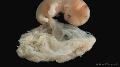 Así luce a las 6-7 semanas, de acuerdo con el sitio humpath.com