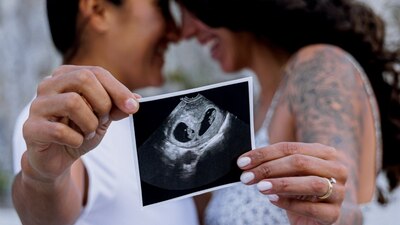 Las mujeres compartieron la gran noticia en sus redes sociales