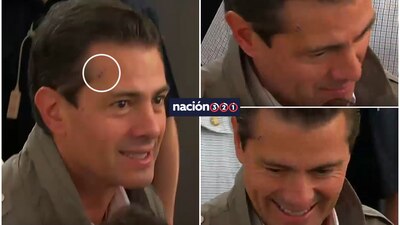 El presidente mostró algunas heridas durante un evento en Cuautitlán Izcalli