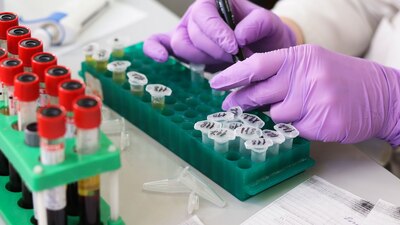 El bamlanivimab es un anticuerpo monoclonal para pacientes no hospitalizados