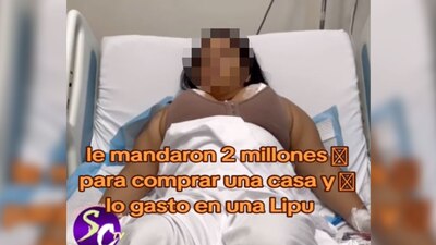 Una mujer decidió gastarse todos los ahorros de su esposo en una cirugía estética