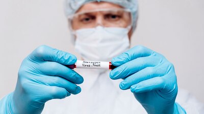 En el Edomex, ya son 5; dos en Toluca, Texcoco, Zumpango y Neza tienen 1