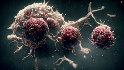 Según el estudio a 40% de la población que ya estaba dada de alta, le reaparecen