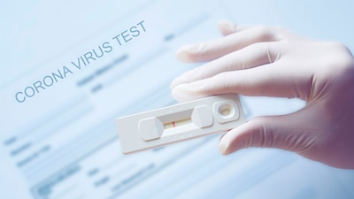 La mayoría de las pruebas que tiene resultados poco confiables se venden por redes sociales.