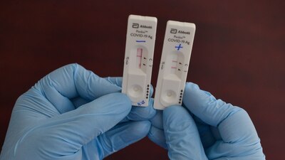 Ómicron es la variante de rápida propagación en el mundo, sin embargo, esto no se debe a la carga viral