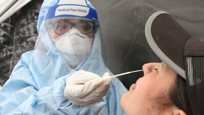 De acuerdo con Salud, la prueba de la OPS, a diferencia de otras, se basa en la detección de antígenos del virus