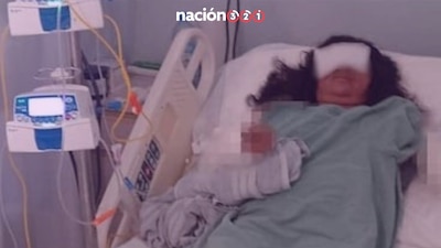 Debido al ataque de los 3 perros, la deportista ya perdió uno de sus brazos