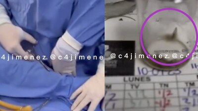 El Seguro Social envió una tarjeta informativa donde aseveró que no se comprometió la salud del paciente