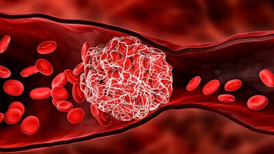 Es importante consultar a un médico antes de iniciar cualquier tratamiento