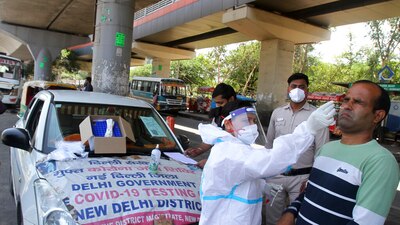 La mucormicosis fue relacionada en India como una secuela grave de pacientes con COVID