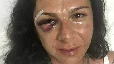 La exvelocista fue derribada de su moto y posteriormente golpeada cuando viajaba de Valle de Bravo hacia la capital