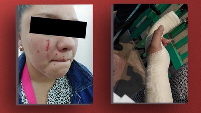 Una enfermera de la CDMX sufrió un brutal ataque por parte de una pareja que no quería que estuviera en la zona