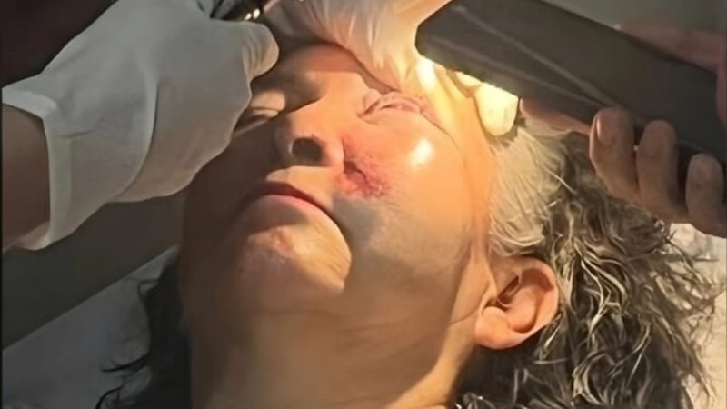 Maestra demanda al gobierno de Querétaro tras perder el ojo por caer en una obra inconclusa