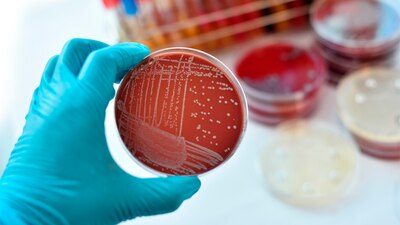 Al 29 de noviembre, se contaba con 15 casos confirmados y cuatro probables, en cuatro unidades médicas del Edomex