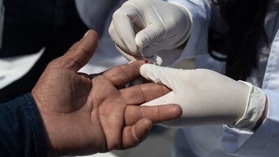 La Ssa informó que 7 de cada 10 personas adultas mayores con VIH son hombres