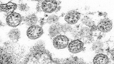 Así se ve el COVID-19 en un microscopio