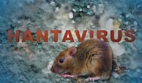 España registra nuevo caso de hantavirus ; suman 11 infectados incluidos 3 muertos