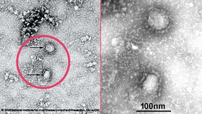 Estas son las primeras imágenes del virus que surgió en China