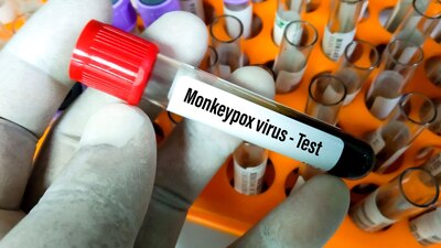 El pasado martes, las autoridades sanitarias alertaron de un caso positivo en un hotel del puerto