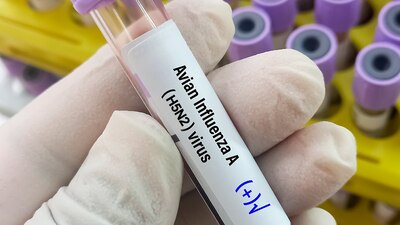 Tras la confirmación de la OMS, te contamos qué malestares puede causar la influenza (H5N2)